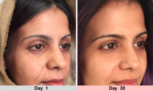LumeTone Golden Restore