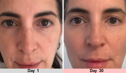 LumeTone Golden Restore