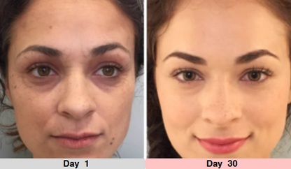 LumeTone Golden Restore