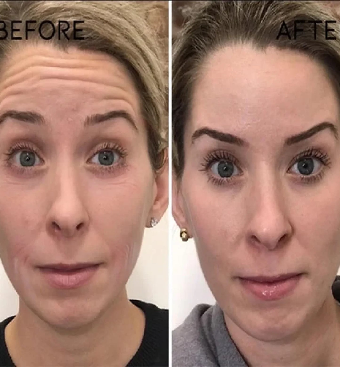 LumeTone Golden Restore